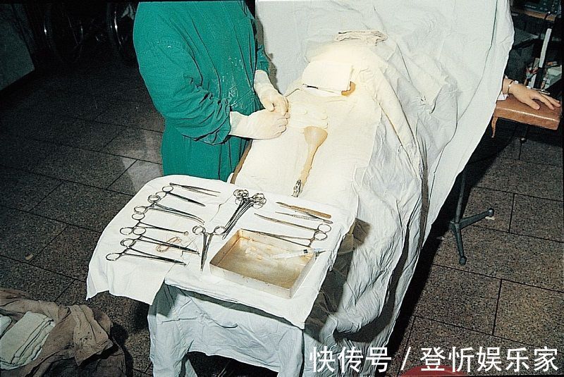 伤口|剖腹产只是“挨一刀”就完事看完手术全过程,忍不住心疼女人