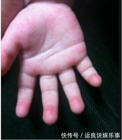 宝妈|孩子2个部位出汗多,是脾胃差,家长牢记“3不要”,脾胃渐渐好