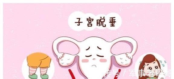 子宫脱垂|产后最易染上4种“月子病”,第一种新妈妈都中了,如何避免?