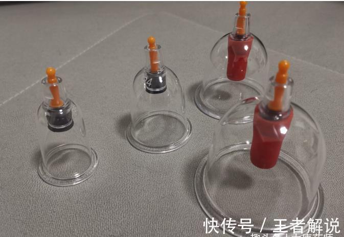 多高大上|不通则痛!5个小方法,不花一分钱,轻松搞定肩颈疼痛!值得一试