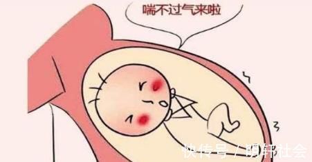 宫高|如果孕期有四种症状,胎儿可能不健康,你需要及时就医