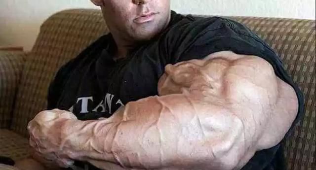 大重量|26岁健美冠军,小腿突发意外,体脂太低是“原罪”