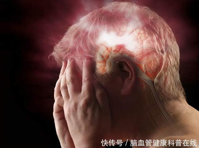 中老年人|55岁大妈头晕突发脑梗,只因日常生活不在意,这五种预防要知道