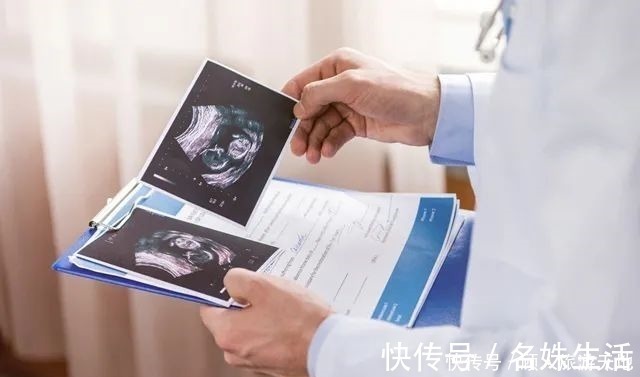 发育|四维彩超单上的三个数据,暗示胎儿发育好不好,孕妈学会看更省心