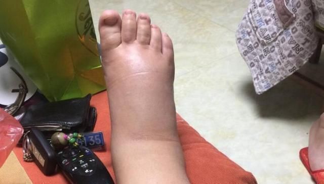 产检|准妈妈孕期没有这4种现象,说明胎宝“很疼”妈妈,中一条也幸运