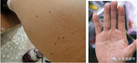 南昌|紧急提醒 ！南昌疾控：注意预防蠓虫叮咬！