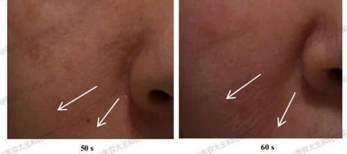 皮肤|你的日常=最强衰老预警难怪你没有姐姐们的逆天状态