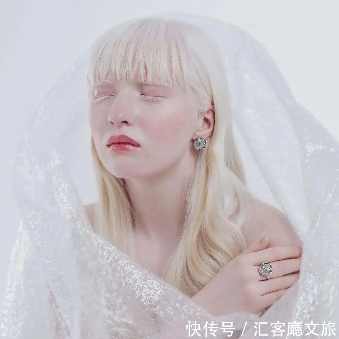 逆袭|因“全身雪白”被遗弃的中国女孩,逆袭成超模的故事让人泪目
