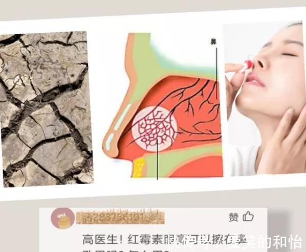 鼻堂|清鼻堂:鼻炎党们要当心!这些鼻炎妙招可能一点也不妙!