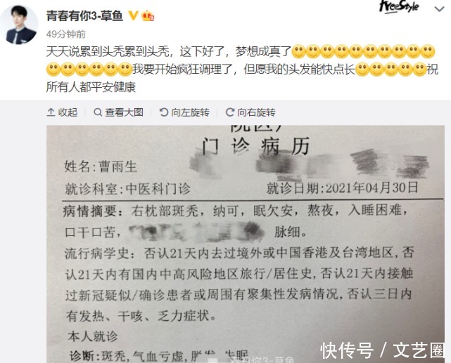 《青你3》训练压力大？草鱼晒斑秃诊断报告后，罗一舟也被发现斑秃