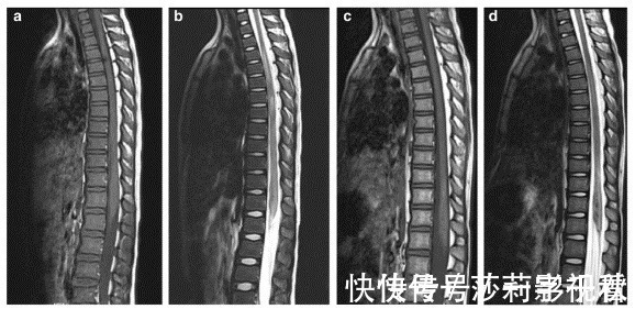 胸髓|医生的孩子,为啥都不去学舞蹈?这可能是孩子圈的潜规则