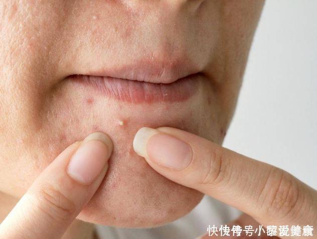 便秘|宿便堆积，会导致便秘教你一招刺激大肠蠕动，清肠道、排出宿便