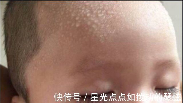 脾胃|“脾胃虚”的宝宝,身上这2个部位经常出汗,父母早了解娃早受益