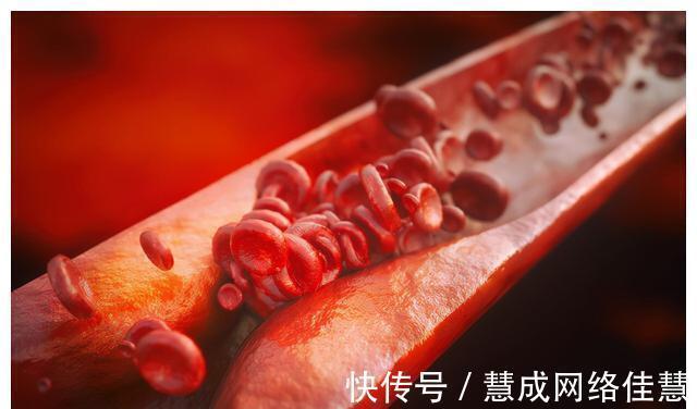 甘油三酯|不吃药,真能降血脂吗?医生确认了:能!但要认准这2种高血脂