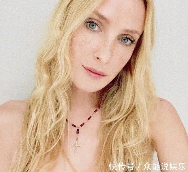 泰勒|奇闻:女子孕检是双胞胎,10个月后生下一个双色婴儿,嵌合体?