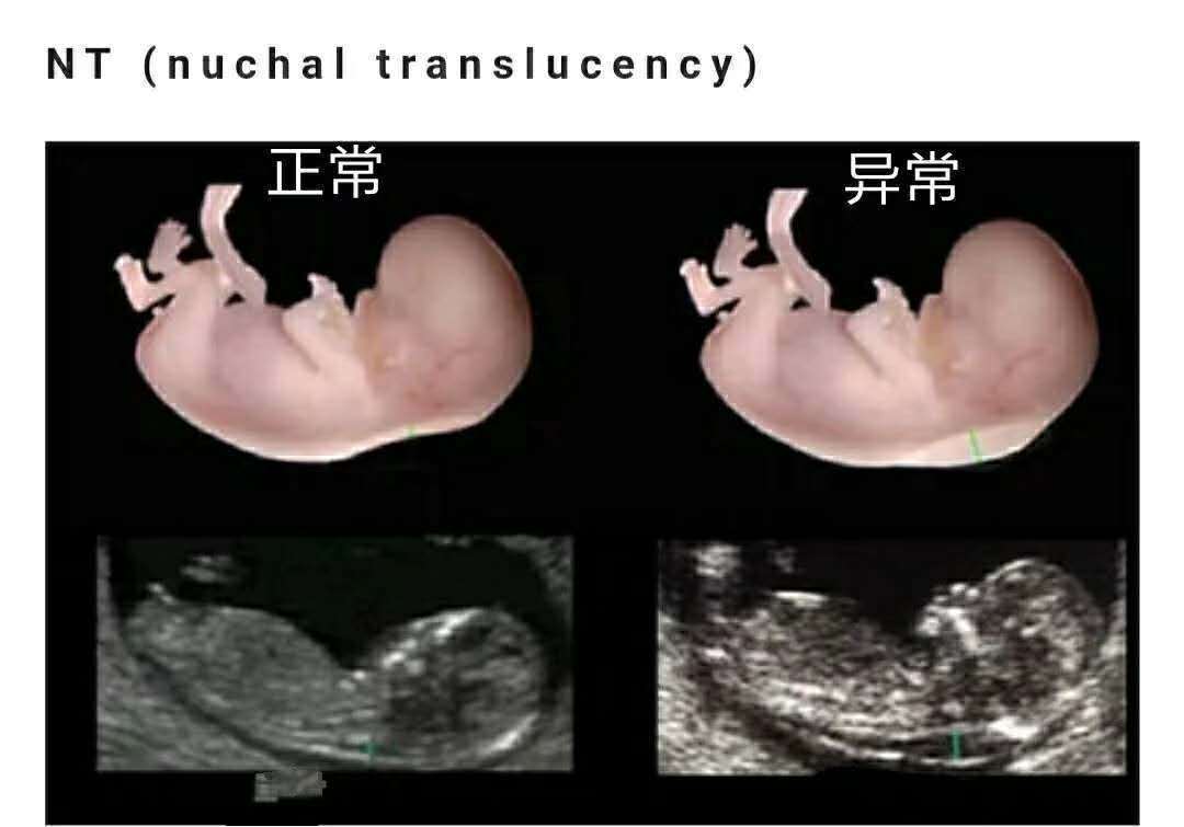 文胸|孕3个月男女胎儿差异大孕妇有这3种“不适”，意味胎儿发育好