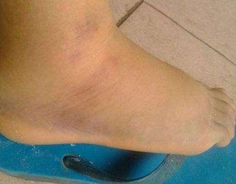 预防|糖尿病四个征兆你中几个6种天然降糖食物,坚持吃,预防糖尿病