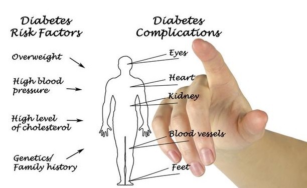 空腹血糖|活在糖尿病恐惧里的人:知道血糖高,但又不想吃药,给你3个方法