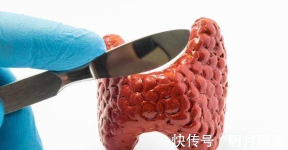 癌癥|頸部突然有三個表現，預示著癌癥要來，不要存在僥幸心理！