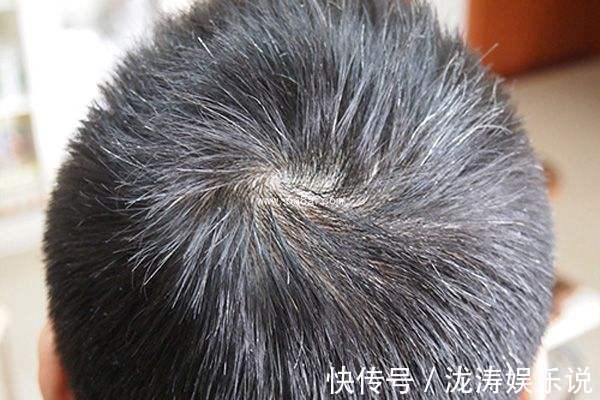 中药|“早生白发”最好用的方子，2味中药泡茶饮，补虚又乌发