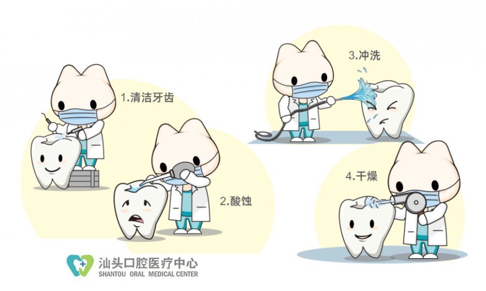 牙齿|窝沟封闭几岁做比较好?做完还会患龋吗?关于窝沟封闭的常见答疑