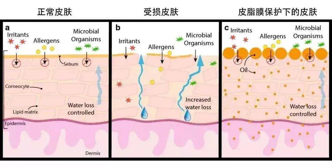 皮肤|风很大的“以油养肤”，是智商税吗？