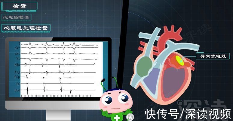 心房|久坐房颤发生率高5倍？酗酒肥胖更易得房颤？房颤发病因素知多少