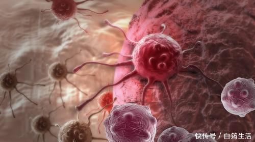 dn2种癌症一旦患上，会飞速发展到晚期越拖越糟糕