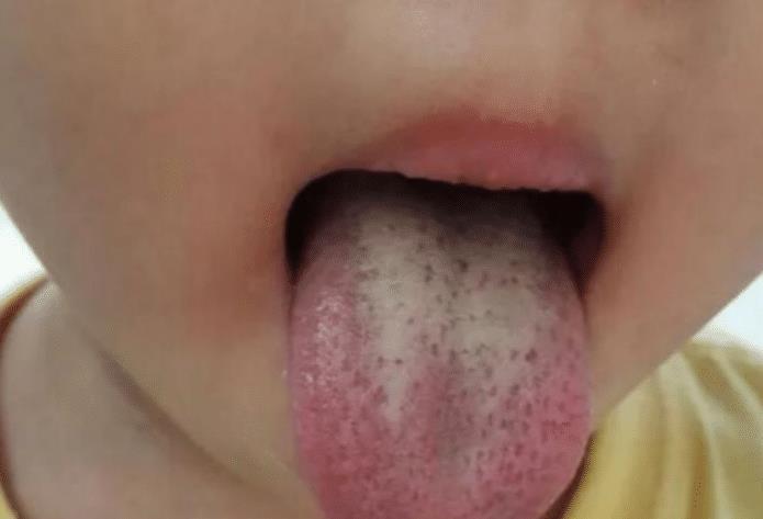 蛋白锌|10岁男童身高已有175,医生:3种食物是身高“加速剂”,日常多食