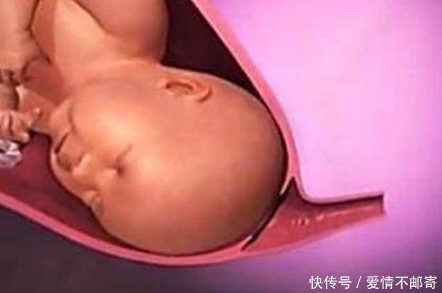 生娃|宝宝那么大,如何从狭小产道出来?了解后方知母爱多伟大!