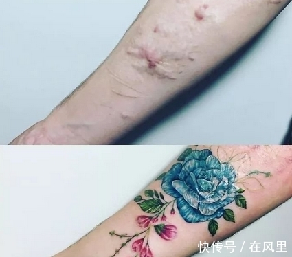 当丑陋的疤痕,遇上纹身师的智慧,原来疤痕也可以变得很美