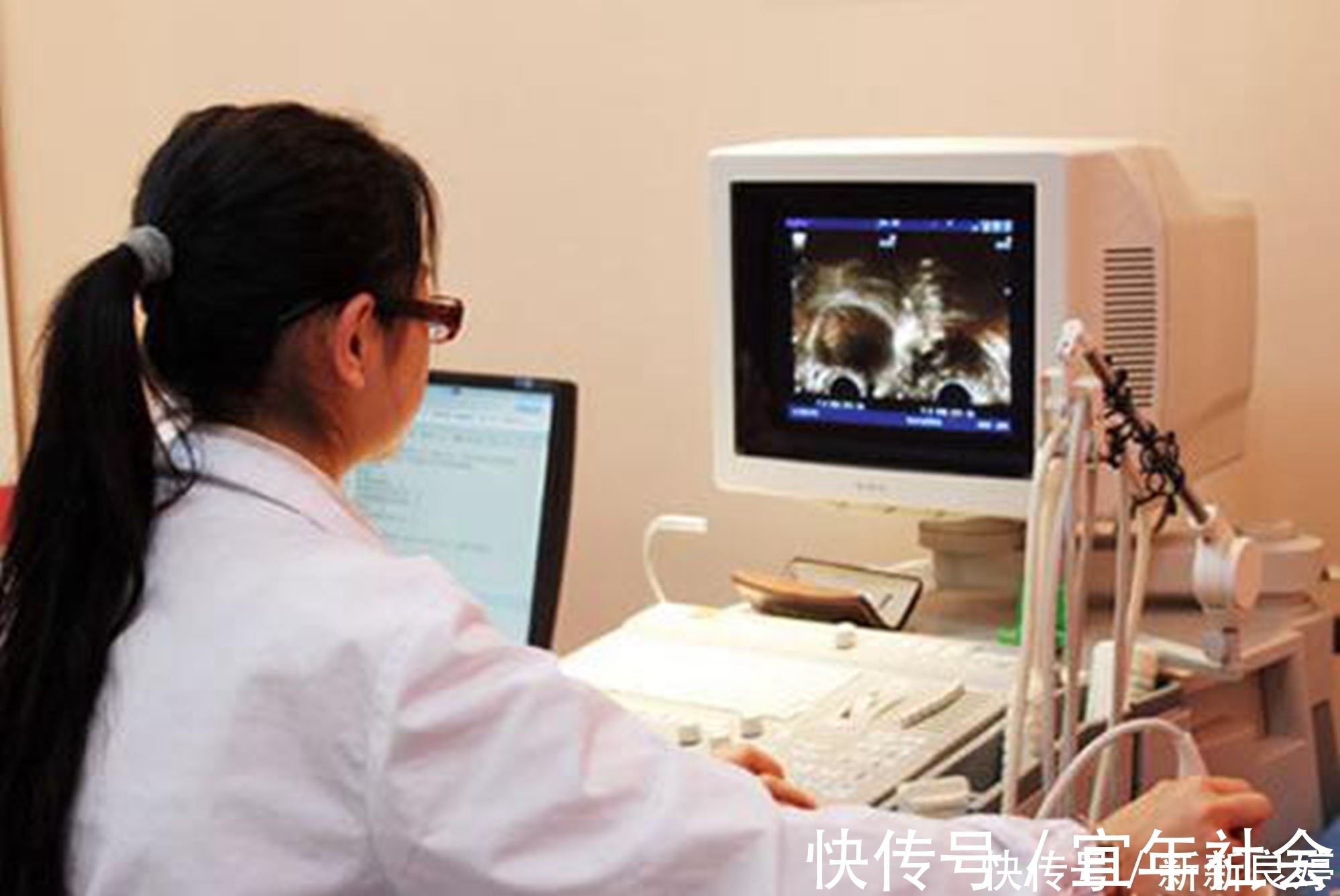 孕期|孕期B超单上四个指标,暗示胎儿健康信号,达标孕妈可以放心了