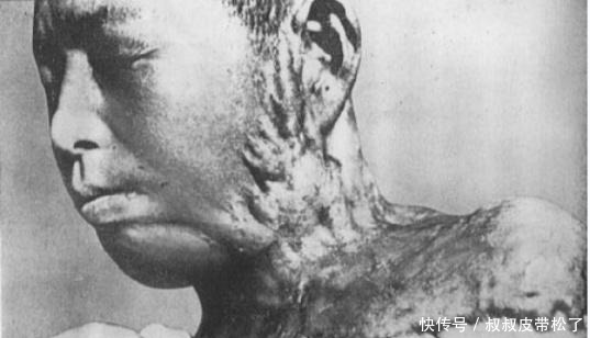 轰炸|日本广岛被原子弹轰炸,74年后的今天,广岛又是怎样一番景色