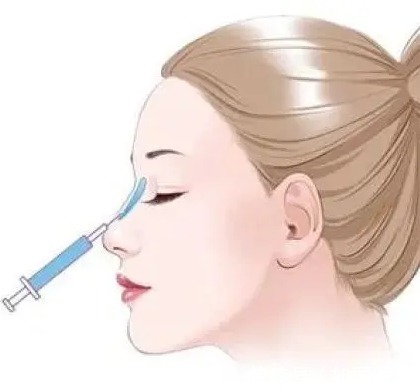 手术 玻尿酸隆鼻可以维持多久?1年?术前准备+术后护理要知道的事!