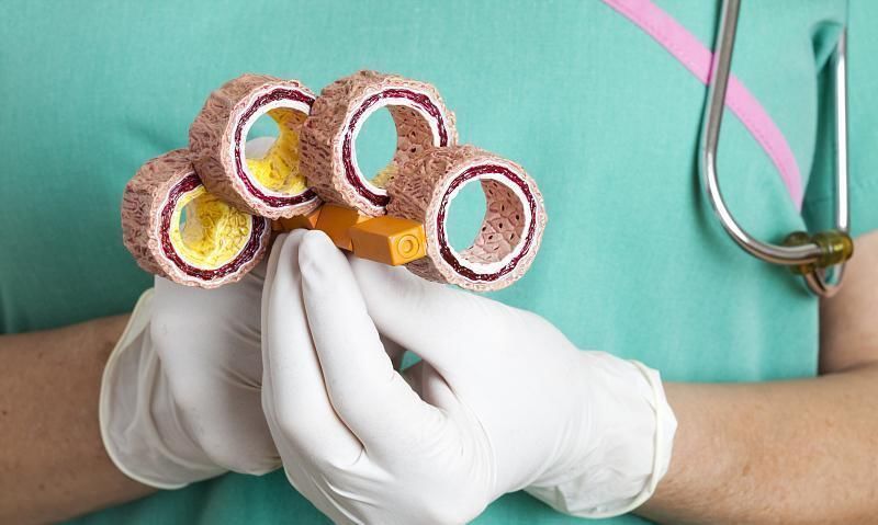 大爷|68岁大爷甘油三酯从86降到17，所幸常做2事，坚持30天，血管通了