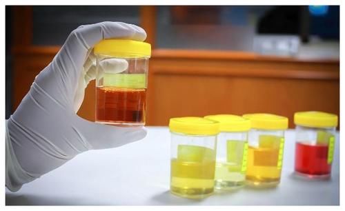 男性朋友|肾好的男人,通常没有“2黑、2臭”,若你也如此,真值得炫耀