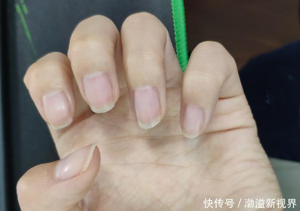 科学|指甲上没有月牙与指甲上有的人，谁身体更健康科学的解释来了