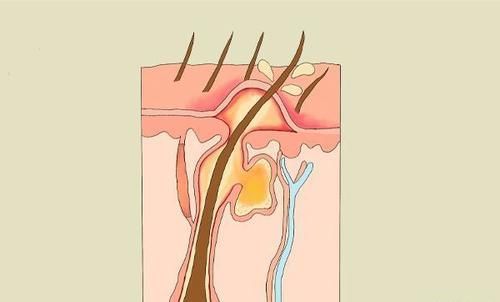 是真的吗|女性体毛浓密,代表了什么?为何有些女性,一根体毛也没有?
