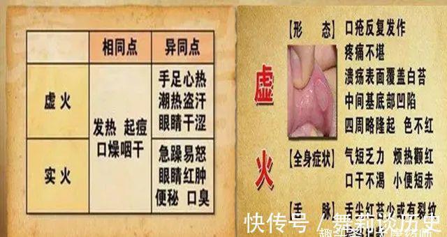 寒湿|身体越寒越上火！中医5大妙招，彻底祛除体内寒湿，终结身体上火