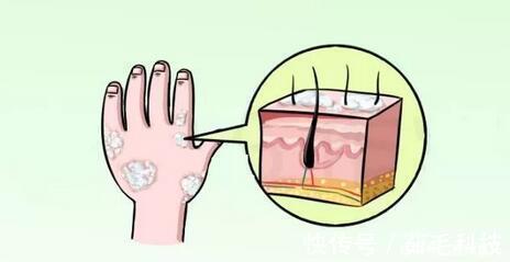 冤枉钱|医生建议这五种疾病只能控制病情,无法根治,别再花冤枉钱了