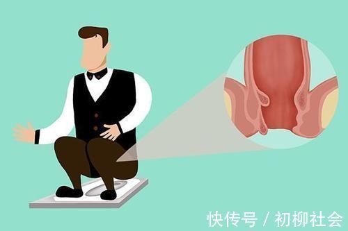 排便|蹲着排便，与坐着排便，哪个更有利健康？很多人的答案是错的