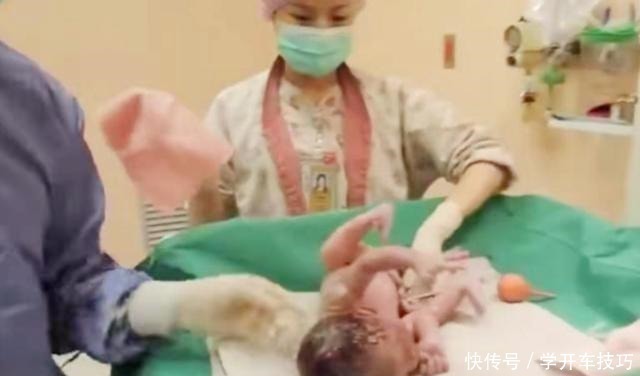 生娃|宝宝出生后被带走十几分钟,这段时间经历了什么组图带你看真相!