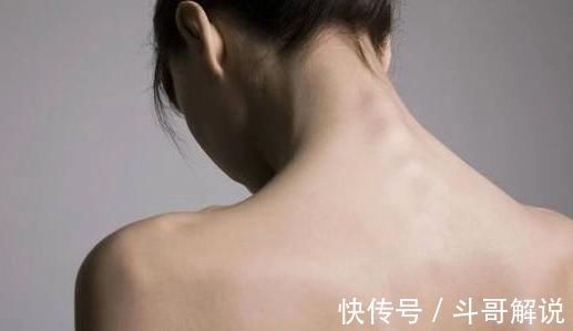 肝脏|4个部位长出痣,为健康最好定期检查,以防癌症悄悄接近你