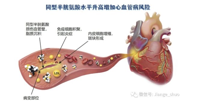 高血压患者|【健哥说心脏】高血压加个“H”，伤心又伤脑