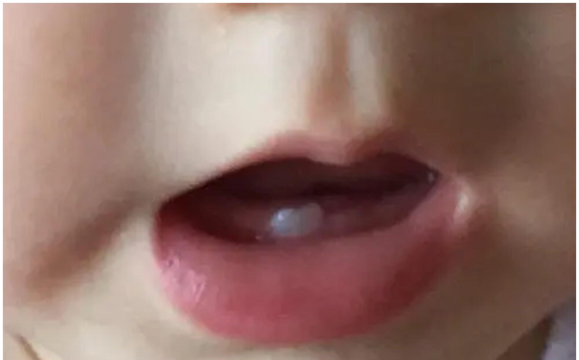 乳牙|宝宝几个月长牙正常?这份宝宝“乳牙萌发和护理表”,请家长收下