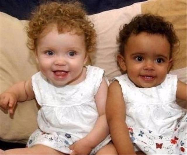 父母|“混血夫妻”生“黑白双胞胎”,奥利奥姐妹今已长大,基因真神奇