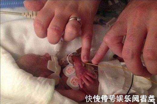 婚戒|生命斗士!出生体重不到1斤,手能穿过戒指,英迷你婴儿长大了!