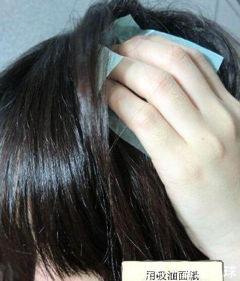 提醒:头上有螨虫的人,可能会有4种表现,别忽视了!