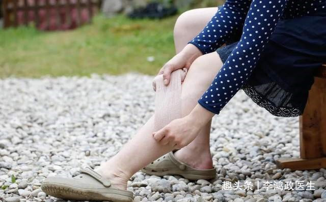 蛋白质|女子双脚水肿，诊断肾病综合征，直到出现咳嗽医生才发现是肺癌