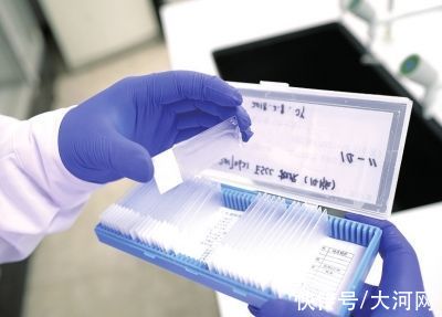 样本|郑州大学食管癌防治国家重点实验室：希望能把食管癌变成像感冒一样的小病